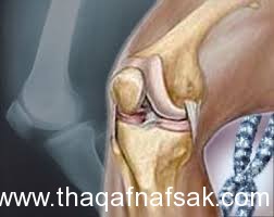 فوائد الفراولة ,, ثقف نفسك