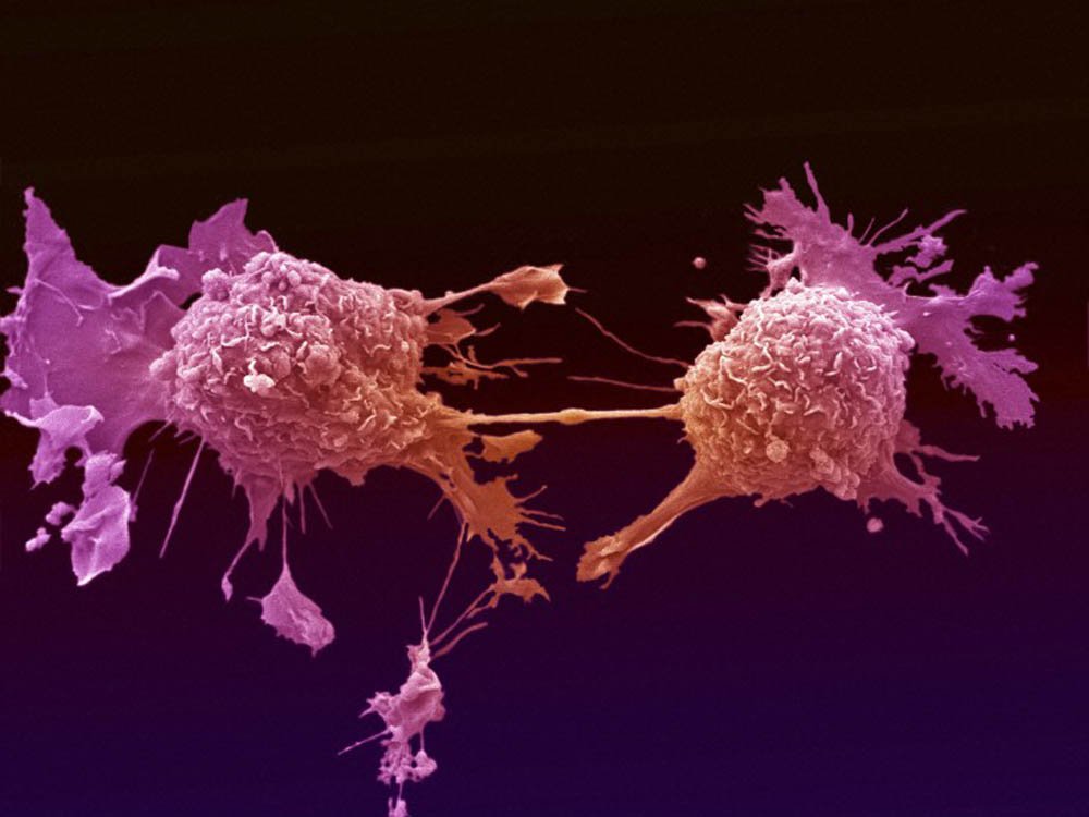 091216a-lung-cancer-cells