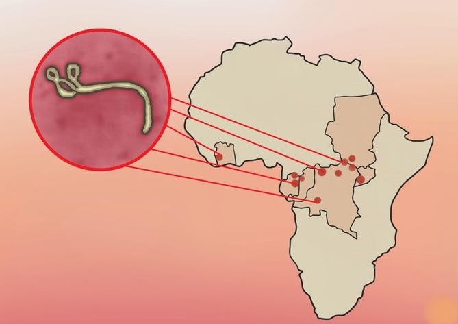 مرض الإيبولا