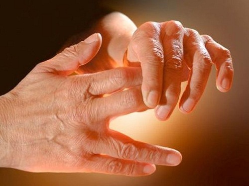 أسباب وعلاج تنميل اليدين والقدمين ثقف نفسك