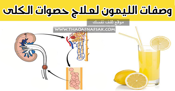 علاج حصى الكلى بوصفات الليمون ثقف نفسك