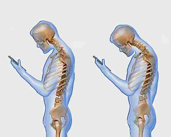 Texting-Posture-Back-Pain-Problem