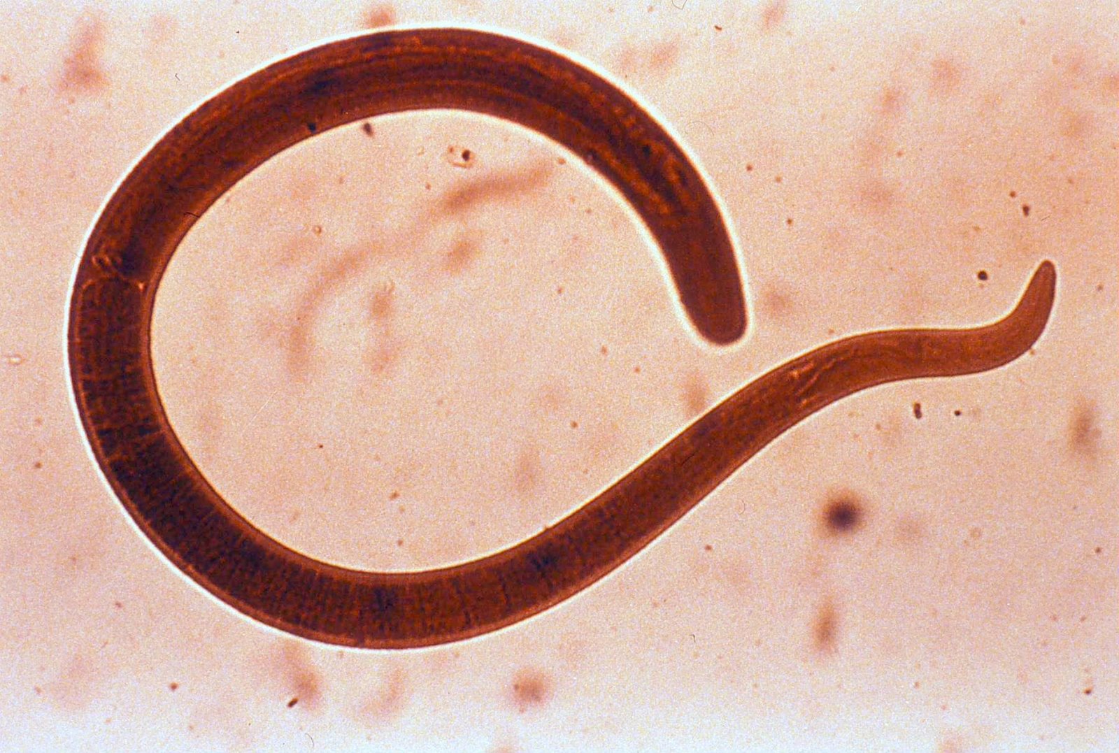Matenda a Tapeworms: Zomwe zimayambitsa matenda ndi njira zothandizira - Dziphunzitseni nokha