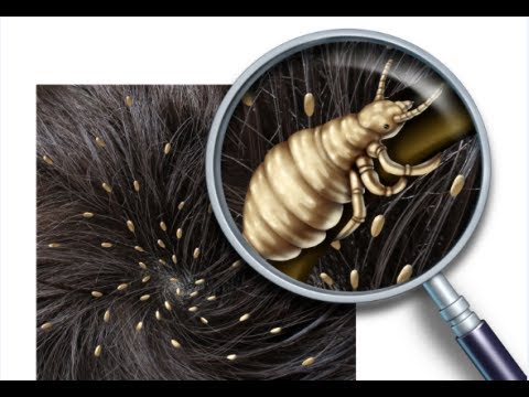 حشرات الشعر