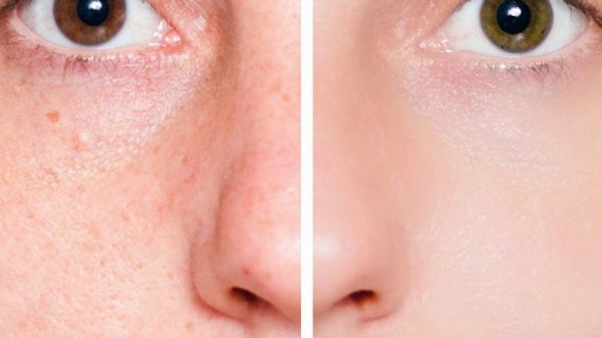 وجه السدادة لصندوق بقالة العاصفة Findlocal Drivewayrepair Com