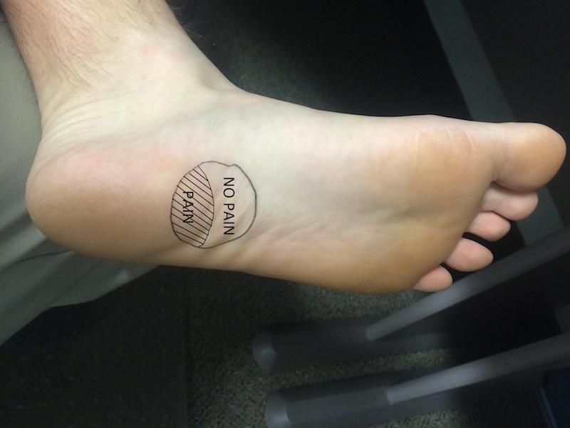 أسباب آلام الكعب لماذا أشعر بها من حين لآخر ثقف نفسك