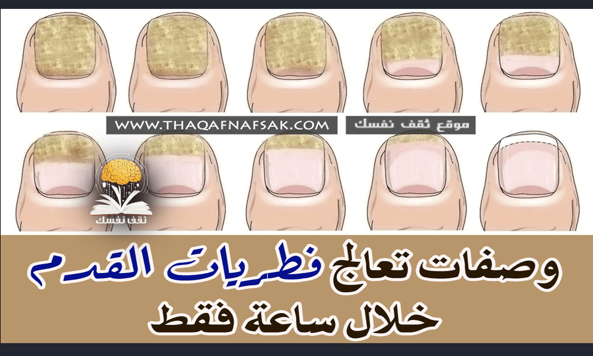 علاج فطريات القدم خلال ساعة فقط ثقف نفسك