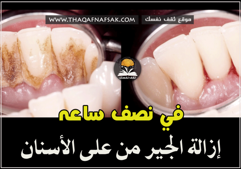 كيف ازيل الجير من الاسنان