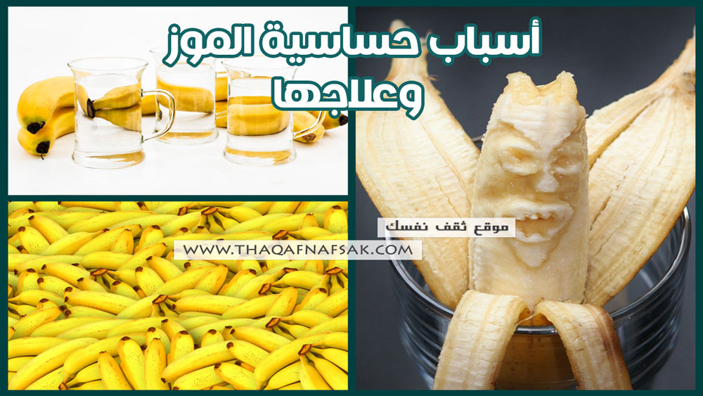 علاج حساسية الموز