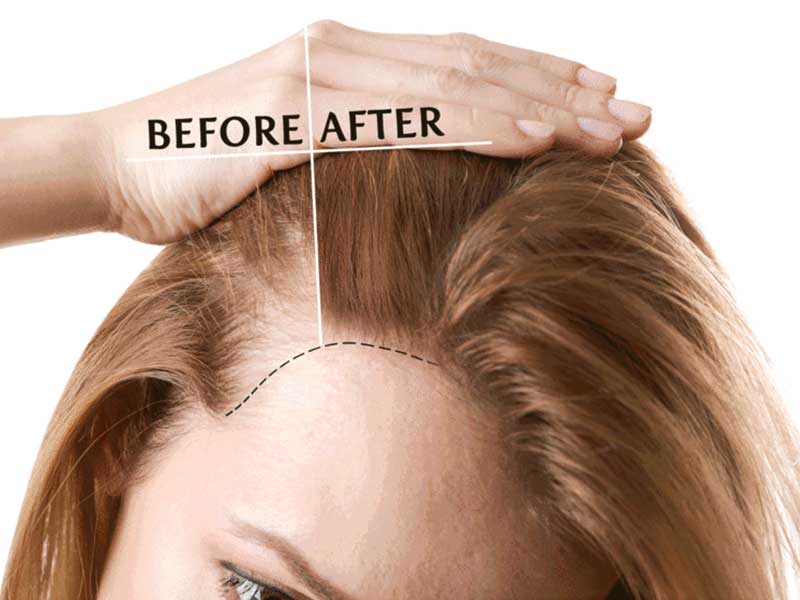 collagen benefits for hair