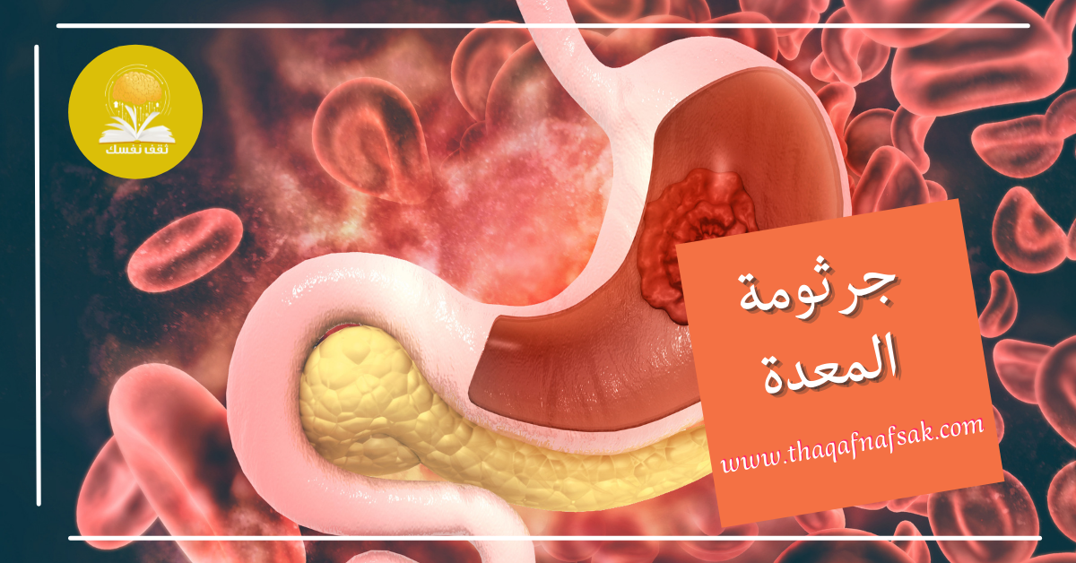 جرثومة المعدة