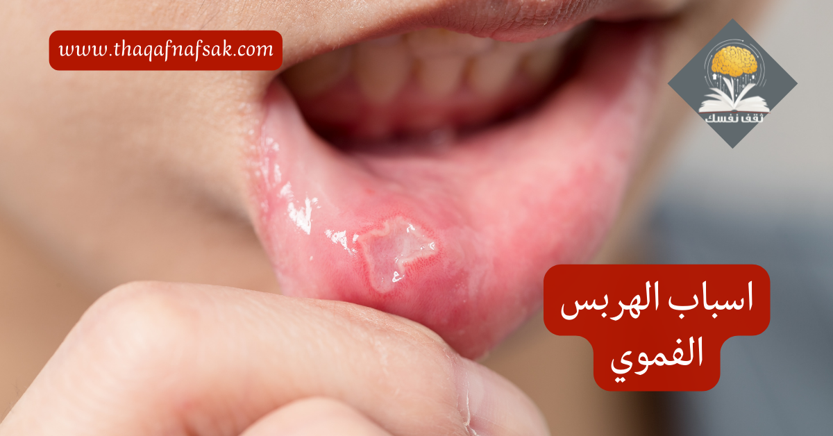اسباب الهربس الفموي