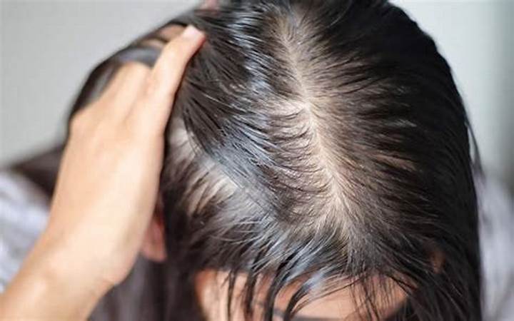 علاج تساقط الشعر الناتج عن خلل الغدة الدرقية 