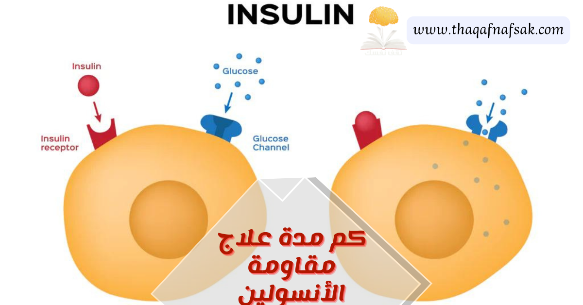 كم مدة علاج مقاومة الأنسولين