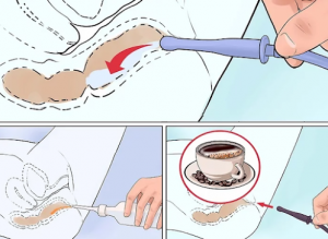 كيفية تحضير حقنة شرجية بالقهوة