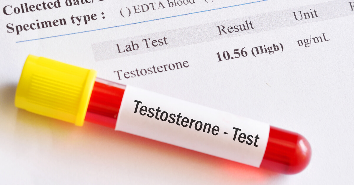 تحليل هرمون التستوستيرون