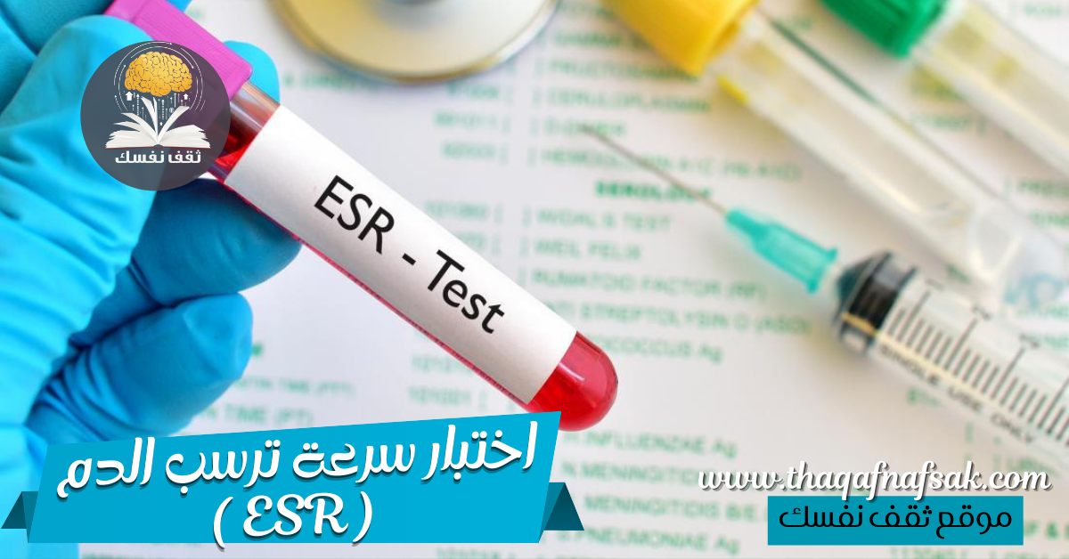 اختبار سرعة ترسب الدم ( ESR )