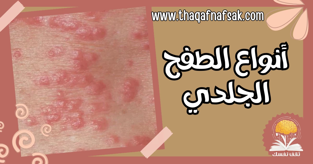 كيف تميز بين أنواع الطفح الجلدي الشائعة بالصور